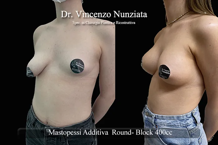 asimmetria paz10 002