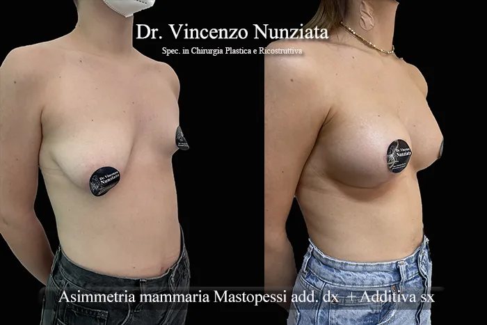 asimmetria paz10 003