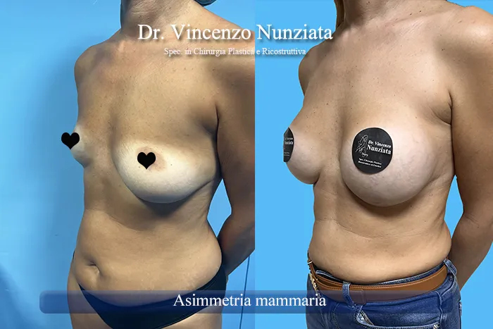 asimmetria paz11 003