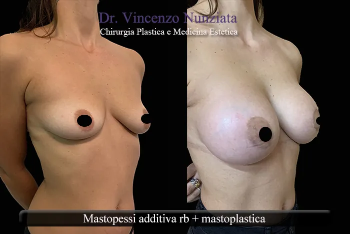 asimmetria paz9 001