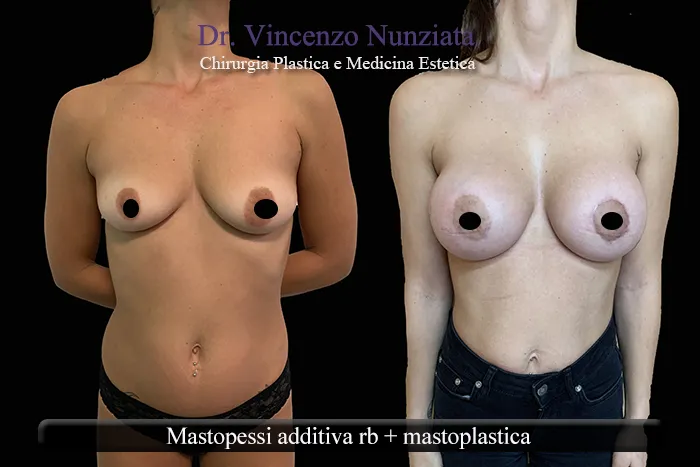 asimmetria paz9 002