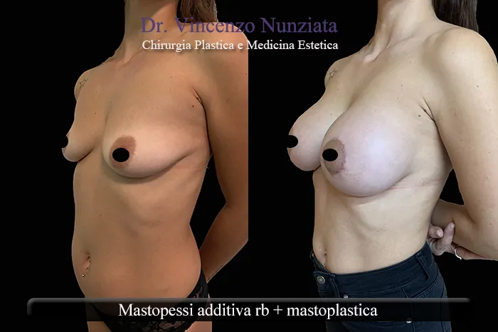 asimmetria paz9 003