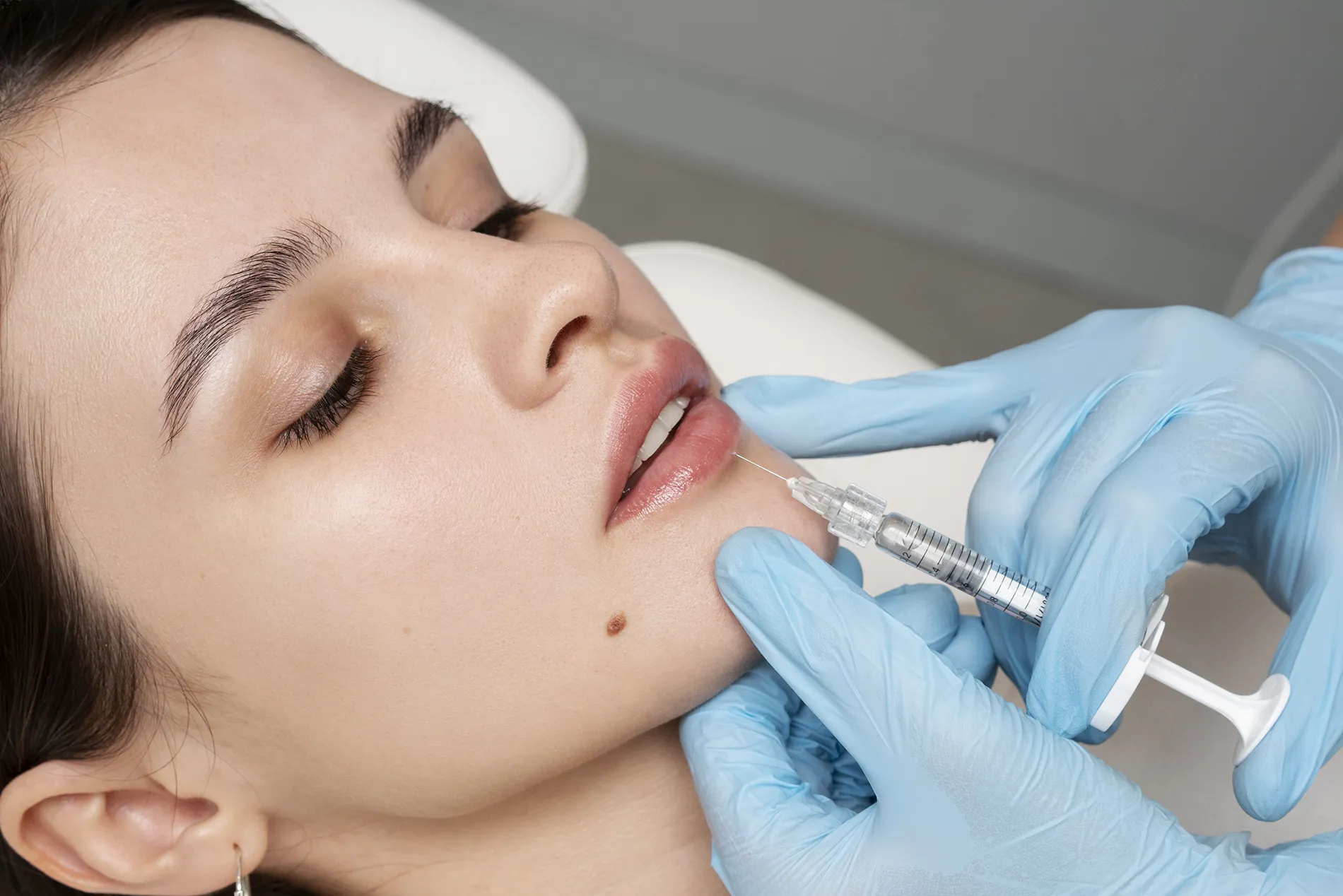 dr vincenzo nunziata fillers top