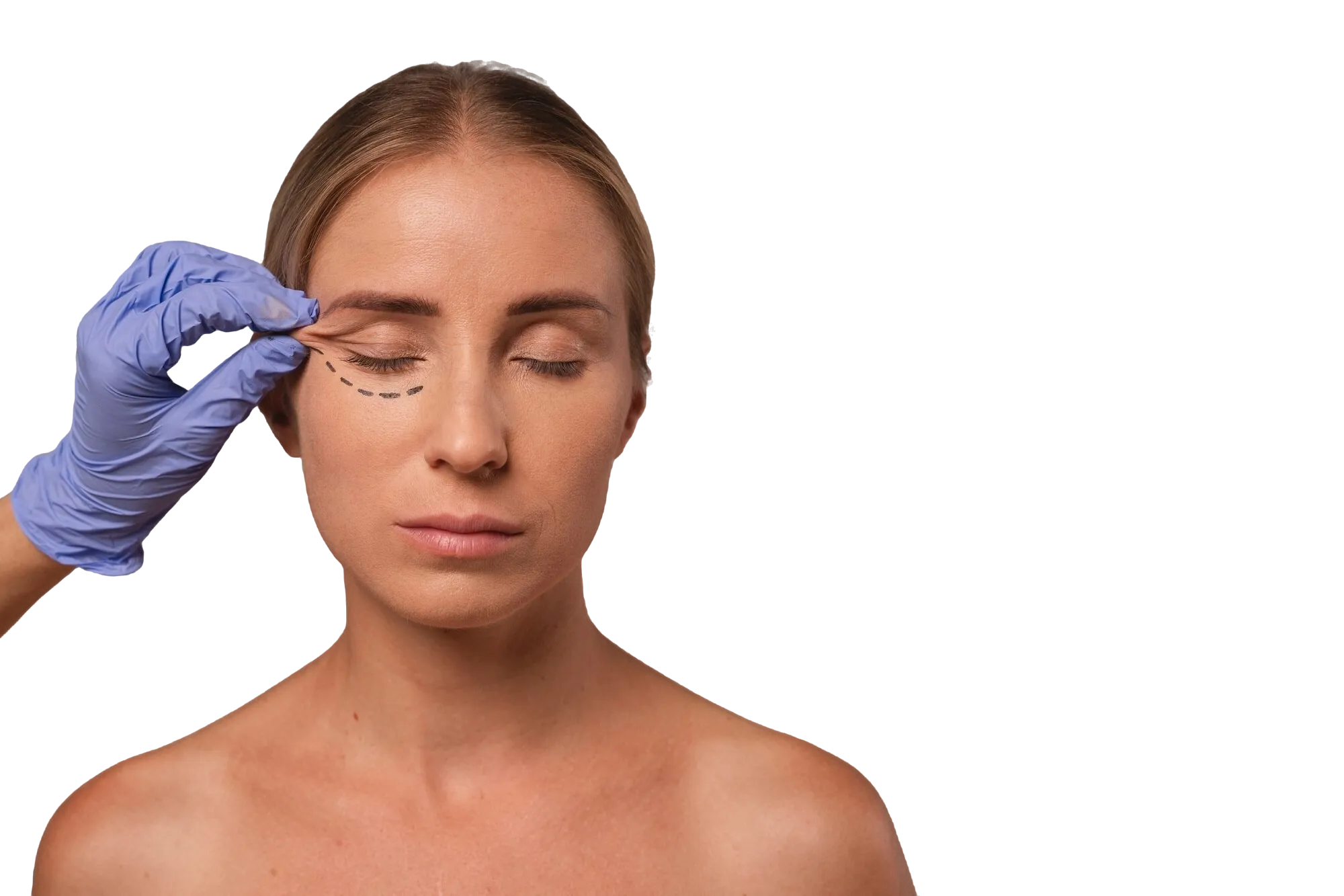 dr vincenzo nunziata lifting eye