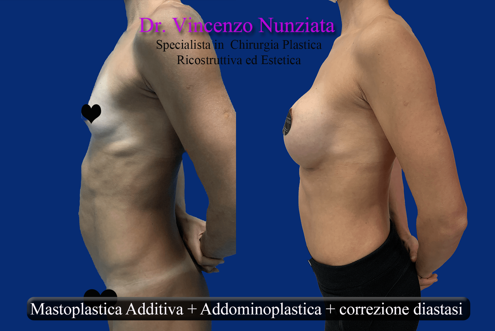 corpo mamma dopo gravidanza 2 instagram