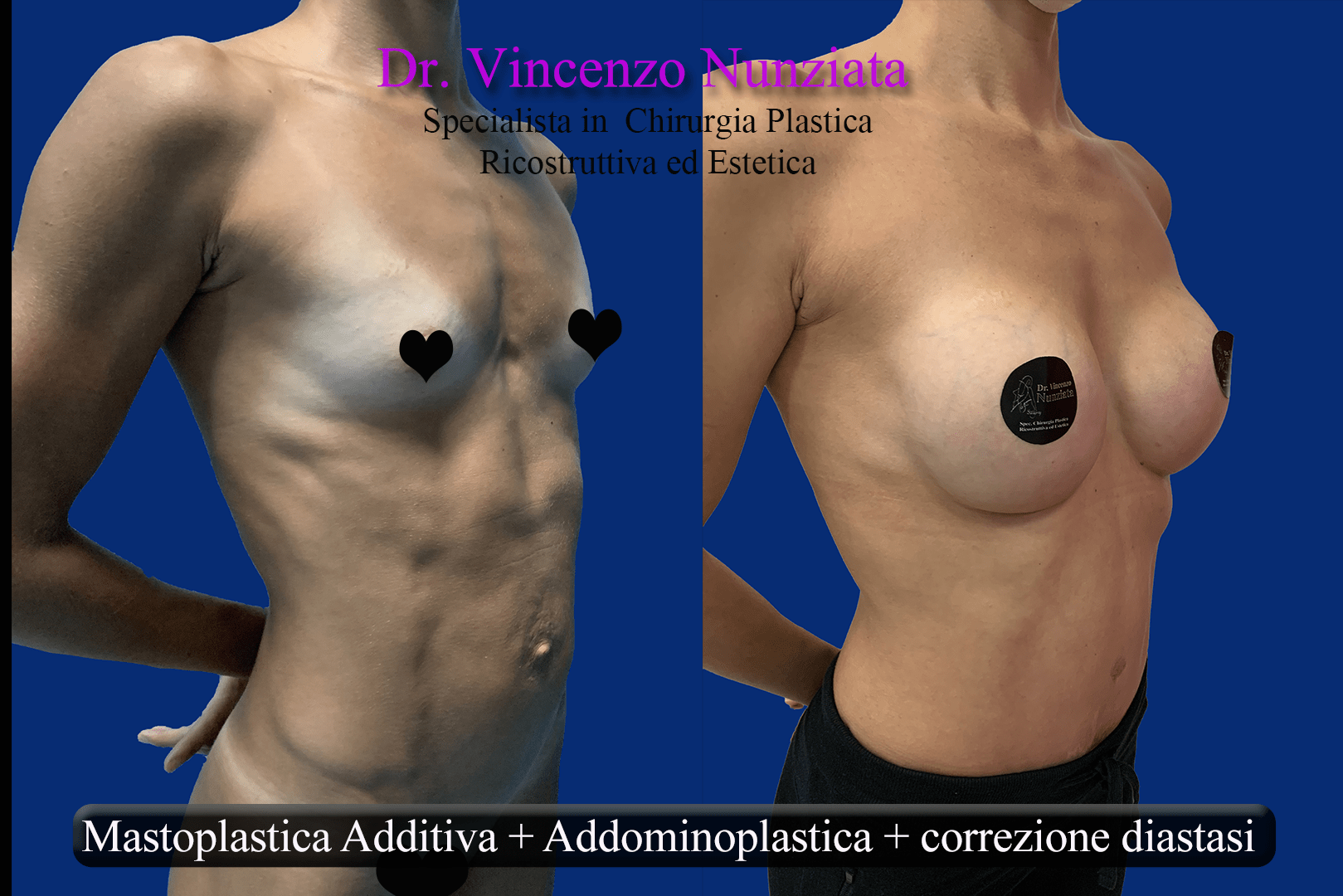 corpo mamma dopo gravidanza 3 instagram copia
