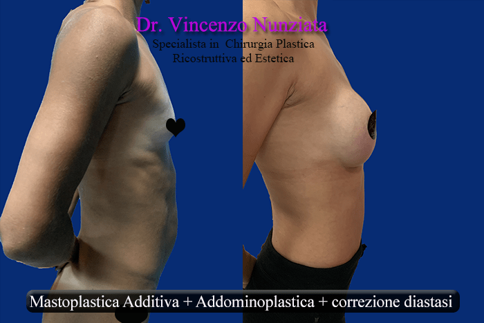 corpo mamma dopo gravidanza 4