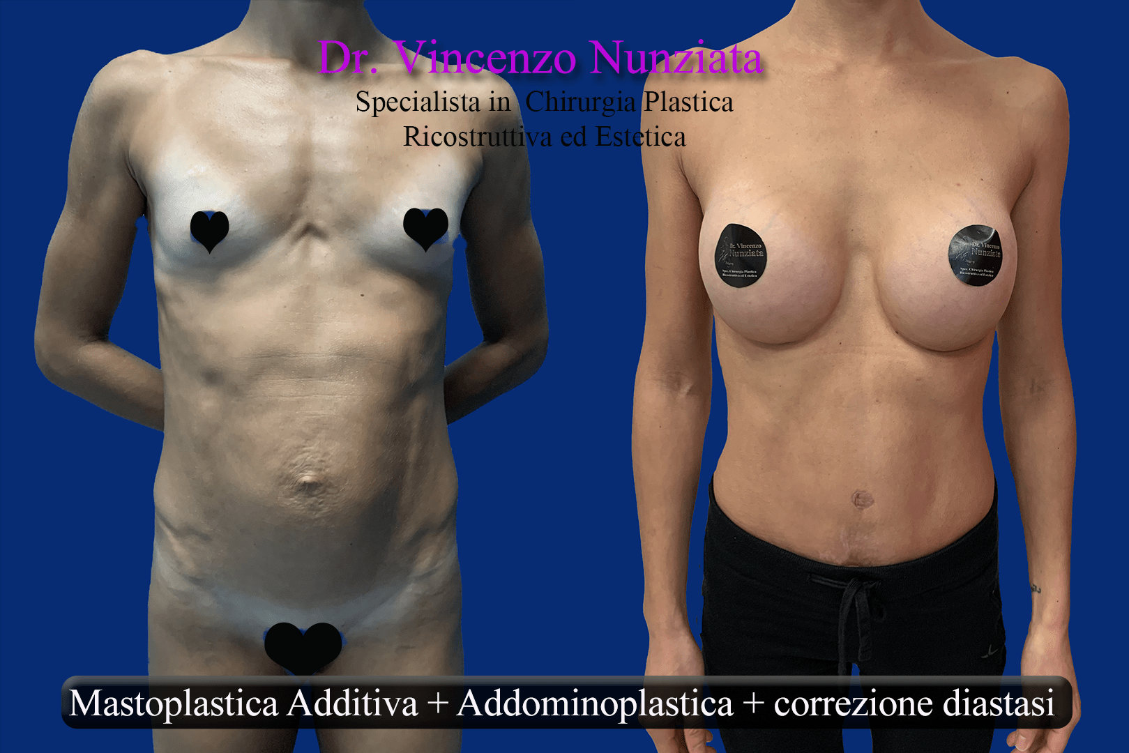 corpo mamma dopo gravidanza instagram