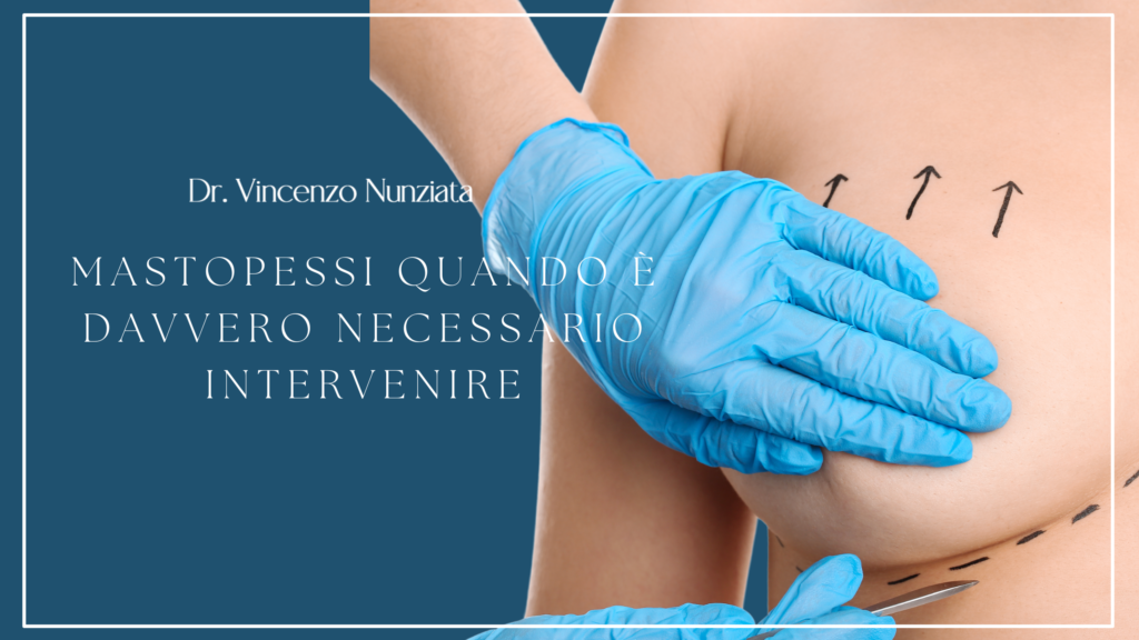 mastopessi quando è davvero necessario intervenire